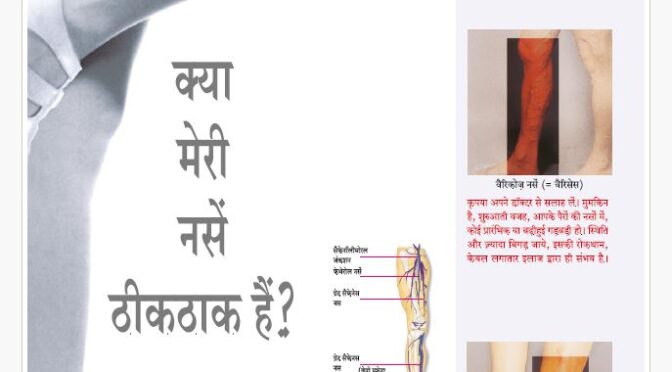 Are My Veins Ok-Hindi BROCHURE