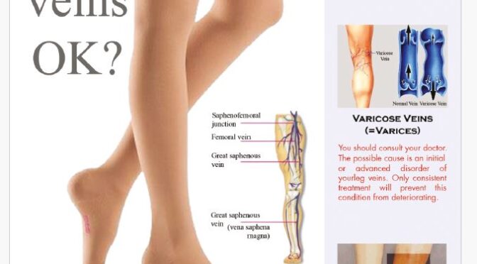 Are My Veins Ok-English BROCHURE