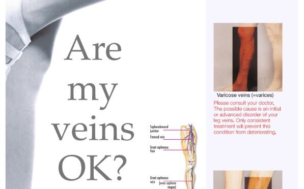 Are My Veins Ok-Multi Language BROCHURE